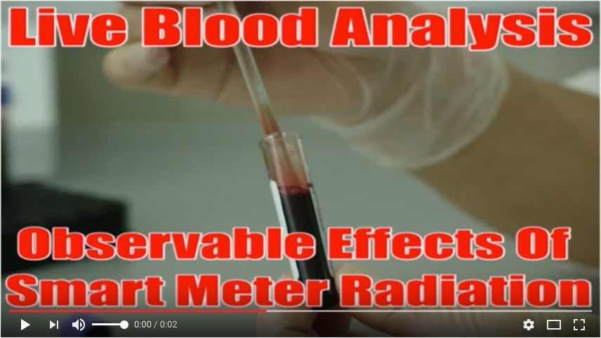 smart meter radiation live blood analysis